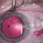 lexummedica-icl-zdj-1