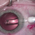 lexummedica-icl-zdj-2