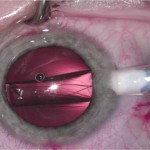 lexummedica-icl-zdj-3