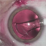 lexummedica-icl-zdj-4