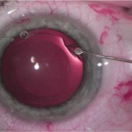 lexummedica-icl-zdj-5