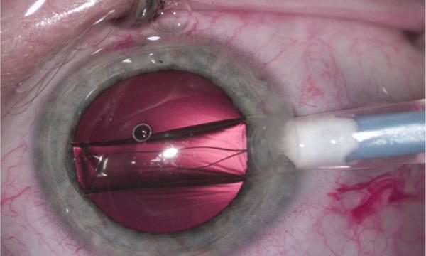 lexummedica-icl-zdj-3