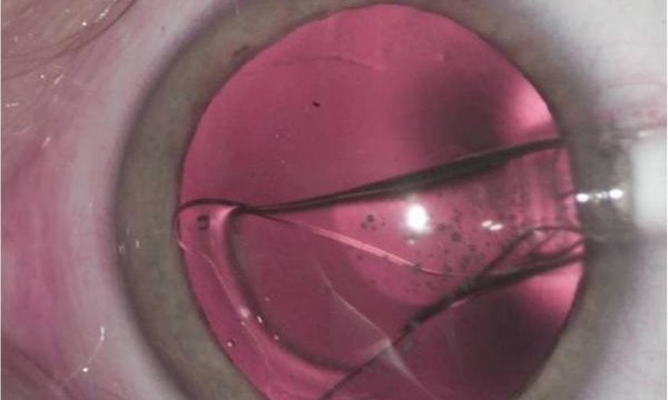 lexummedica-icl-zdj-4