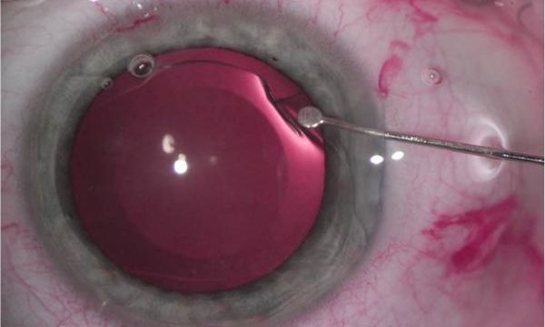 lexummedica-icl-zdj-5